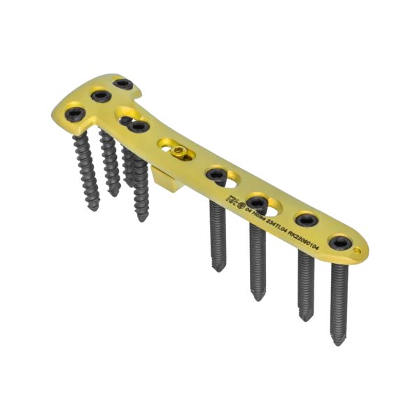 Medial High Tibial Locking Plate with Capsule (with Screw)